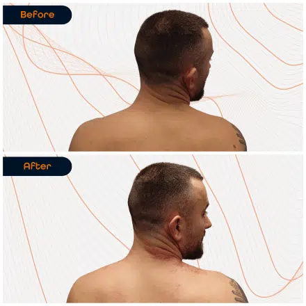 Neck 1