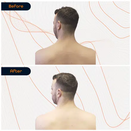 Neck 2