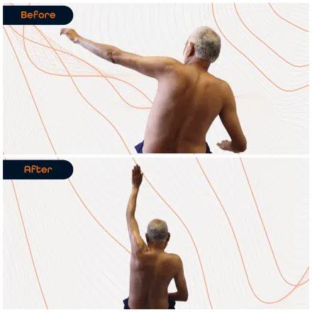 Shoulder 19