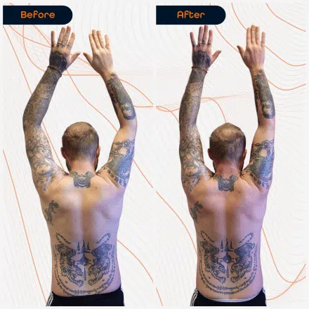 Shoulder 3
