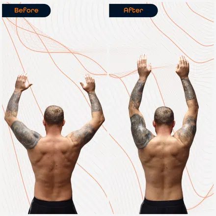Shoulder 5