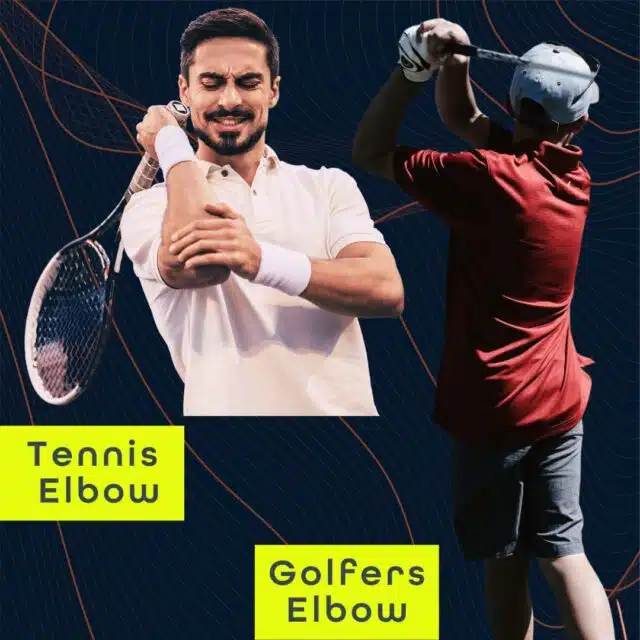 Golfers Elbow Squoosh